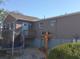 Exterior Facelift Before and After