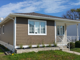 Exterior Facelift 4 Before and After