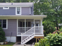 Exterior Facelift 5 Before and After