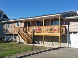 Exterior Facelift 2 Before and After