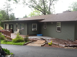 Exterior Facelift 6 Before and After