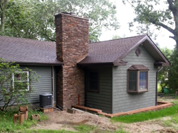 Exterior Facelift 5 Before and After