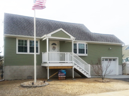 Exterior Facelift 3 Before and After